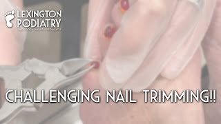 Challenging Nail Trimming!