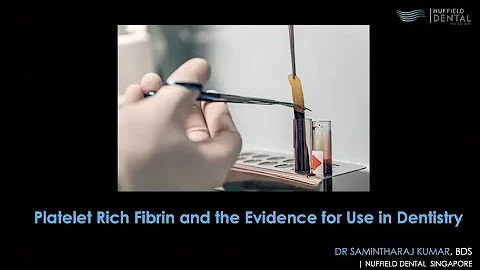 Diş Hekimliğinde Platelet Zengin Fibrin (PRF) Hakkında Ücretsiz Webinar