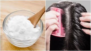 How to use baking soda for dandruff