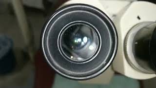 Operating microscpe parts in Eye