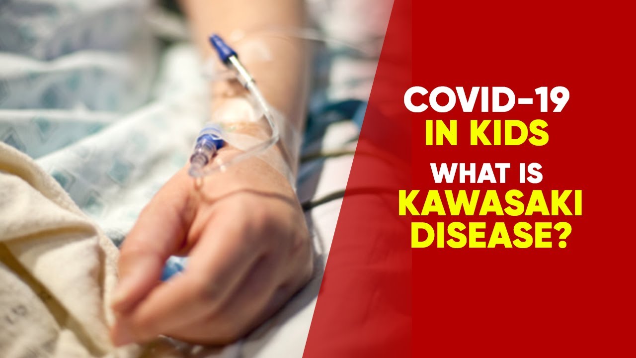 Kawasaki Syndrome What Is This New Disease Detected In COVID19 Recovered Children? NewsMo