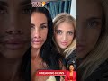 Katie Price Reveals Shocking Results of Emergency Lip Surgery