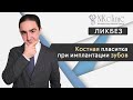 Костная пластика при имплантации зубов  | Блог #7 | NKClinic