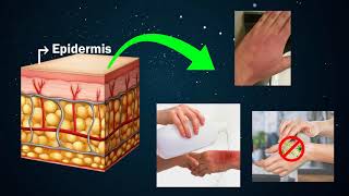 First aid for Burns and Cuts | Treatment for burning