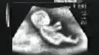 Story whatsap 2019. Baby gasspool #Usg