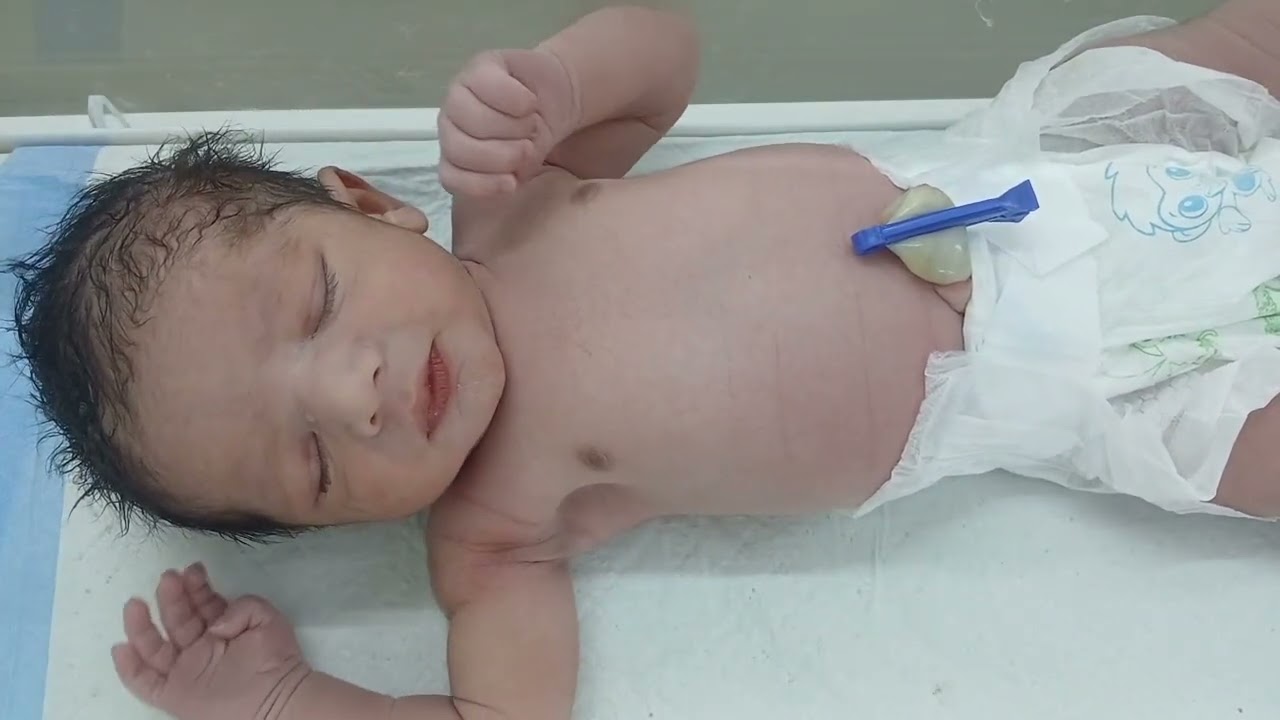 Golden New Born Baby ,The Beauty Standard top level