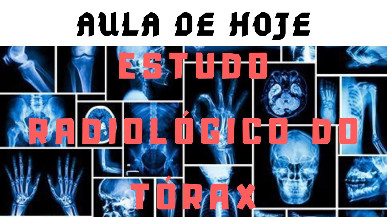 ESTUDO RADIOLÓGICO DO TÓRAX