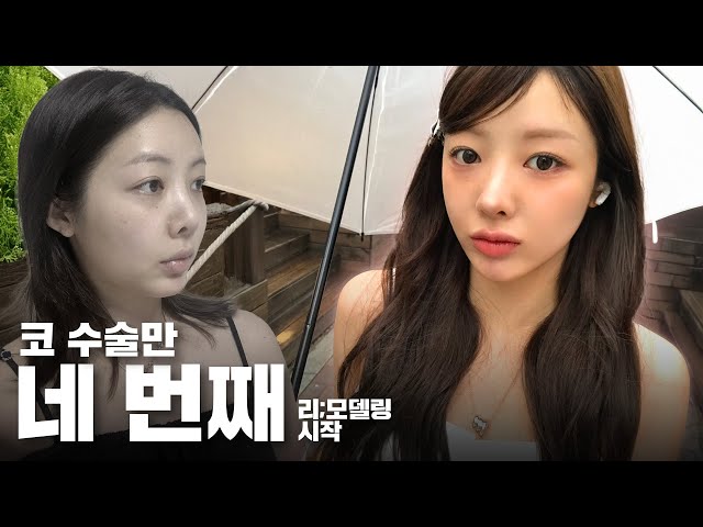 리;모델링 ㅣ "자꾸 코가 들려요.." 구축 코부터 안 빠지는 이중턱까지, 수술 전 인터뷰 ㅣ 비티성형외과