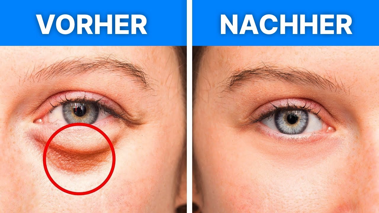 Wunderbar Hausmittel Bei Augenringen Fotos