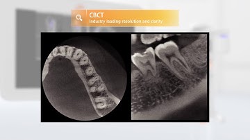CBCT Rayscan Alpha Plus
