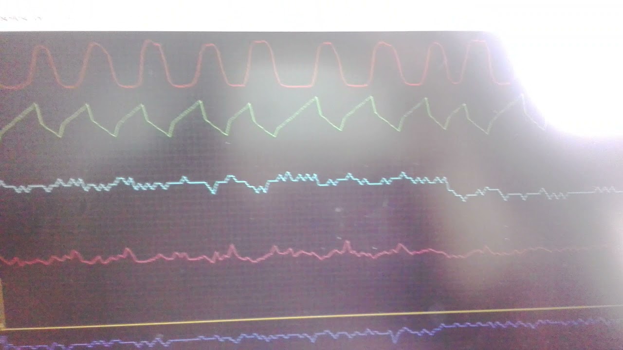 Testing AU falcon fairmont with forscan  checking general health of engine found problem with ripple