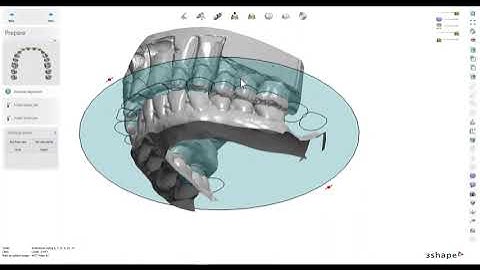 New Bite swap within 3Shape