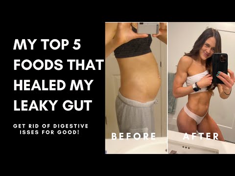 My Top 5 FOODS THAT HEALED MY LEAKY GUT