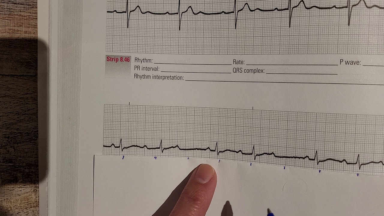 Determining atrial rates and ventricular rates