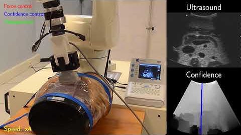 Optimization of ultrasound image quality via visual servoing