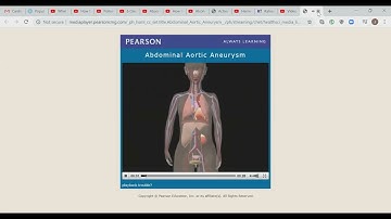 Abdominal Emergencies Lecture 4/4 / EMT MADE EASY