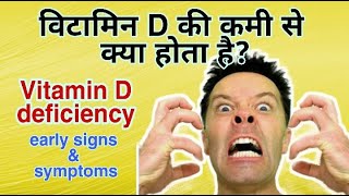 Vitamin d deficiency in India | vitamin d ki kami ke lakshan | vitamin d normal range