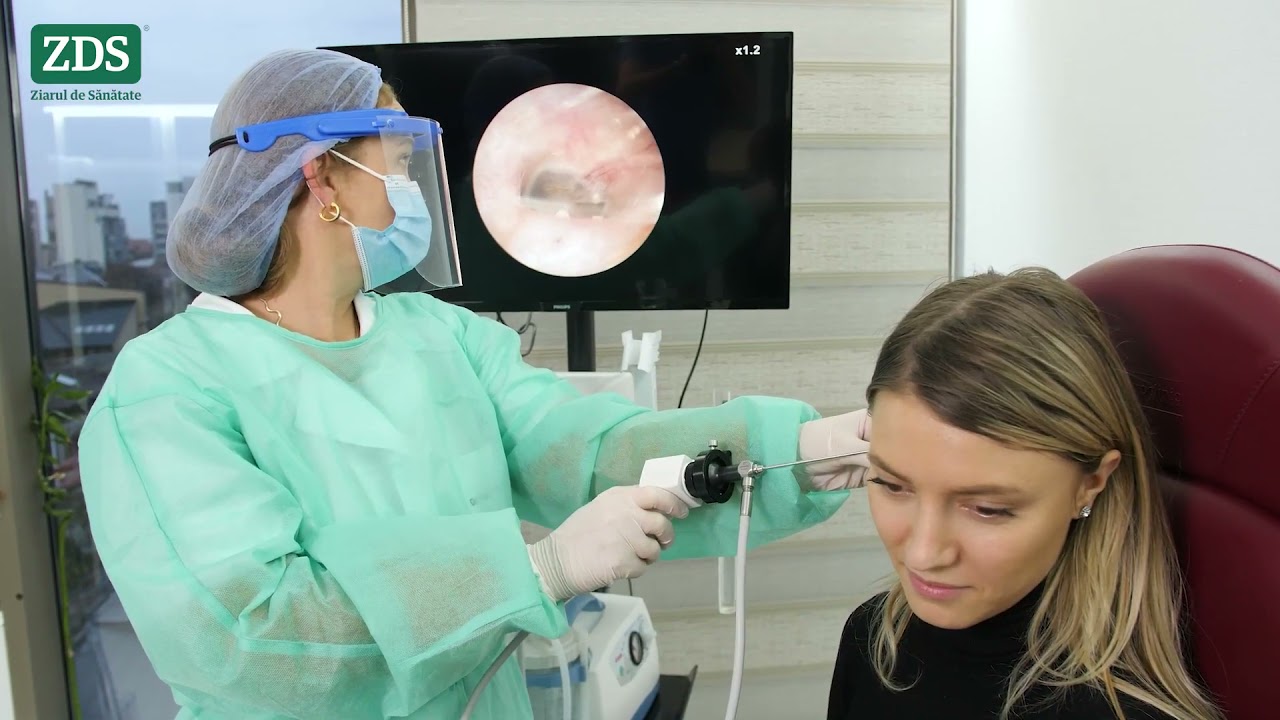 Tinitusul sau țiuitul în urechi 1080p