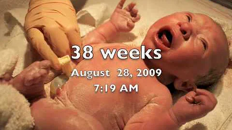 Isabella Kathryn Nicholson -- Month 1
