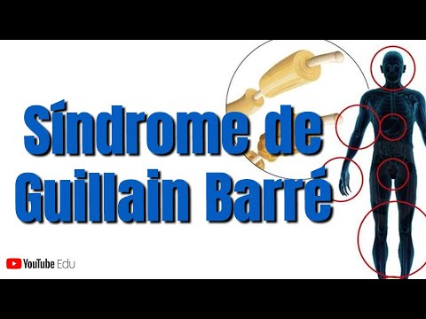 Síndrome de Guillain