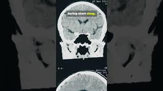 Sleeping 6 Hours The Scary Truthfacts health true