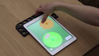 A Tablet-Based App For Carpal Tunnel Syndrome Screening Diagnostic Case-Control Study