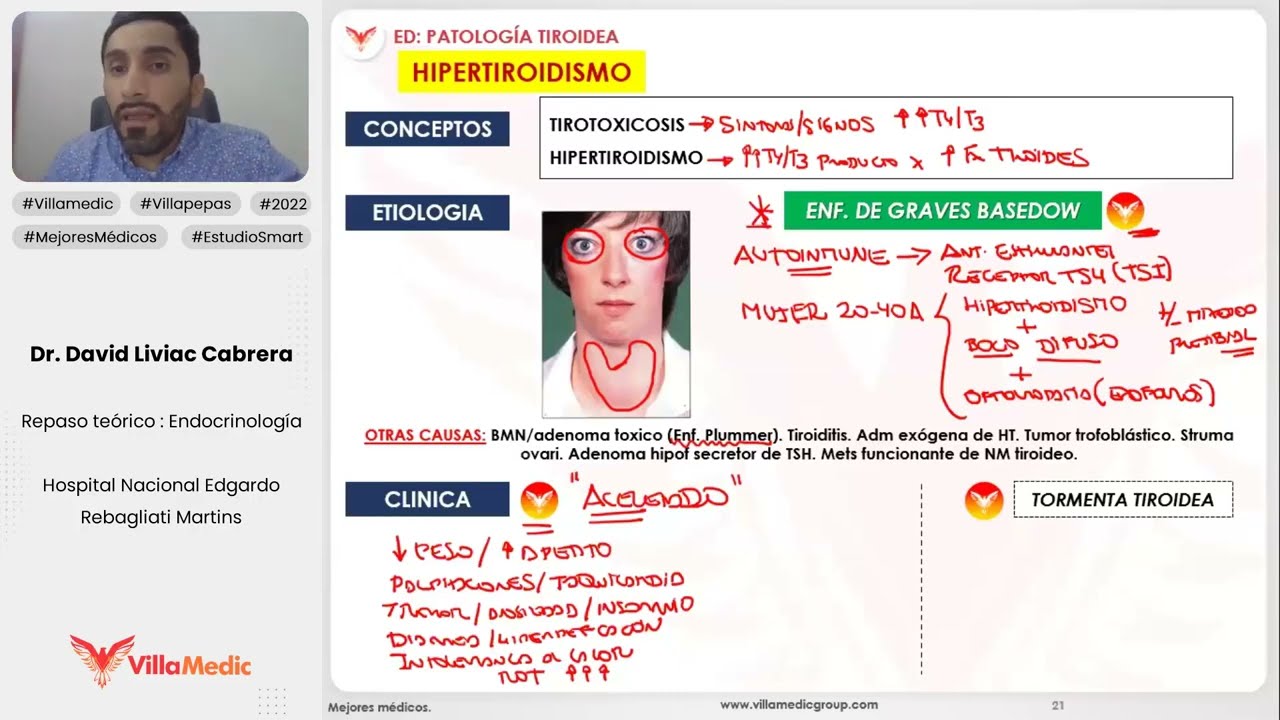 PATOLOGÍA TIROIDEA PARTE 1 - ENDOCRINOLOGÍA - VILLAMEDIC