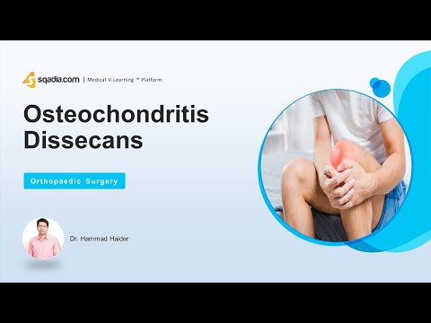 Video: Osteochondrosis: Penyebab Dan Pilihan Pengobatan