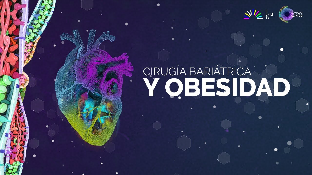 Con Ojo Clínico: Cirugía bariátrica, una opción para la obesidad