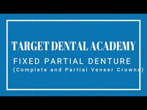 Complete & Partial Veneer Crown | Fixed Partial Denture ...