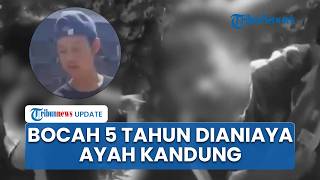 Viral Bocah Lima Tahun Alami Luka di Wajah seusai Dianiaya di Bandung Barat, Pelaku Diamankan Polisi