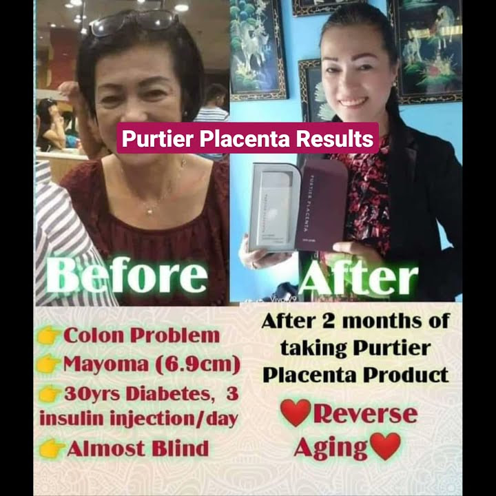 Purtier Placenta Results/ Testimonies