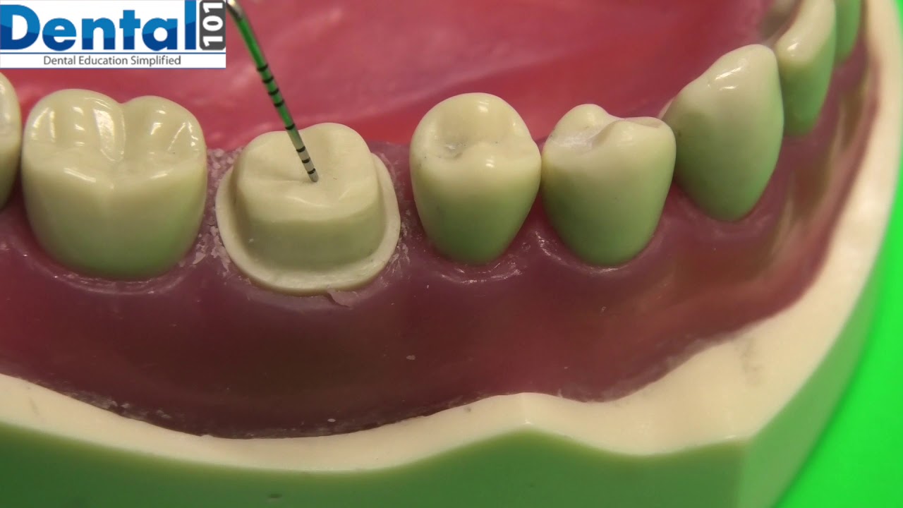 How to self assess: Crown prep task?