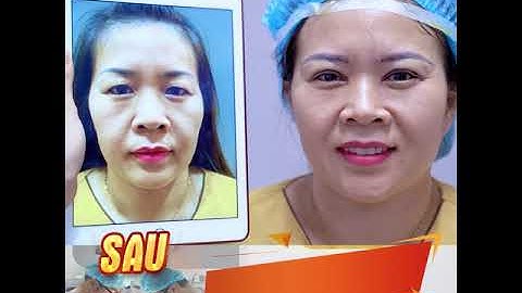 U40+ SỞ HỮU COMBO TRẺ HÓA MẮT TOÀN DIỆN CẮT MÍ + NÂNG CUNG MÀY