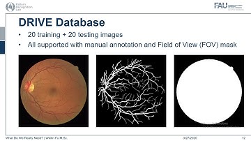 Degenerating U-Net on Retinal Vessel Segmentation