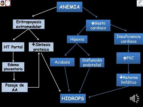 Vídeo: Hidropesía Fetal: Causas, Perspectivas, Tratamiento, Síntomas Y Más