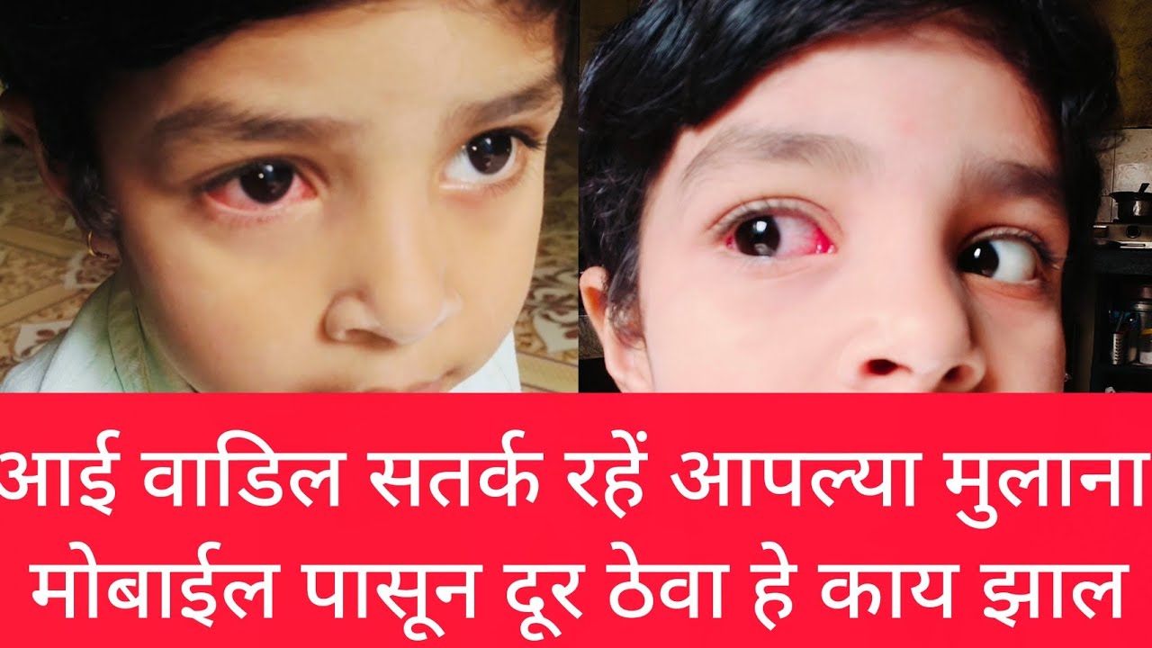 छोटी लेकरनी मोबाईल बाघितल्याने काय होते 