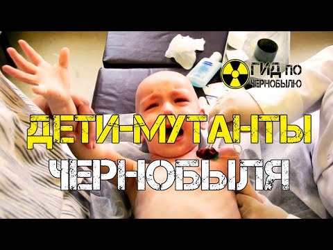 Дети мутанты Чернобыля - шокирующее наследие Чернобыльской катастрофы