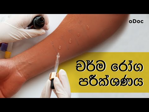 චර්ම රෝග පරීක්ෂණය