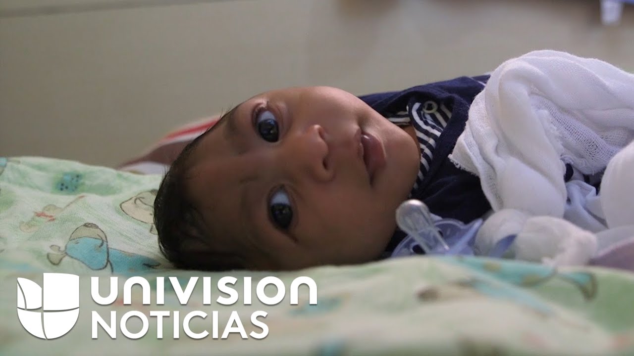 Zika in Brazil: The daily struggle of a mother and her baby with microcephaly