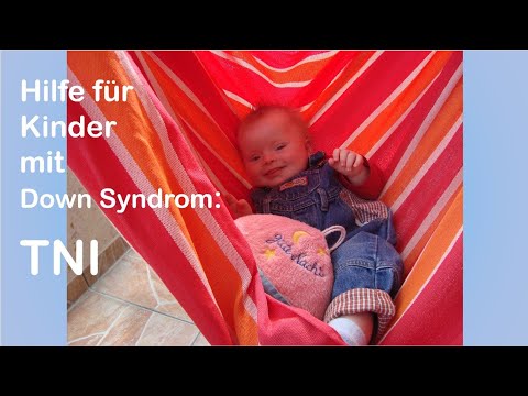 Video: Lungenhämosiderose Bei Kindern Mit Down-Syndrom: Eine Nationale Erfahrung