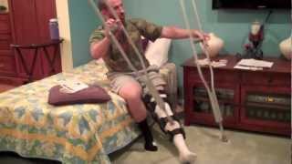 6 days after knee reconstruction surgery with patellar tendon rupture