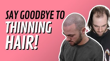 CLIENT TESTIMONIAL VIDEO #1 Hair loss solution. Nathan