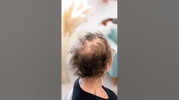 Mesh integration hair extensions #hairtransformation #cancerhairloss #stylebyeve #hairextensions