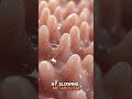 what if your villi disappeared ovenight, could you survive? #anatomy #humanbody