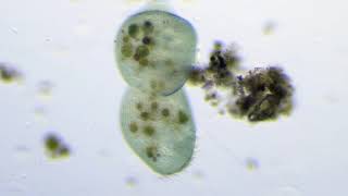Cell division of Stentor Coeruleus