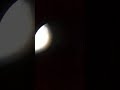 Microscopic view of Motility study by hanging drop method 2