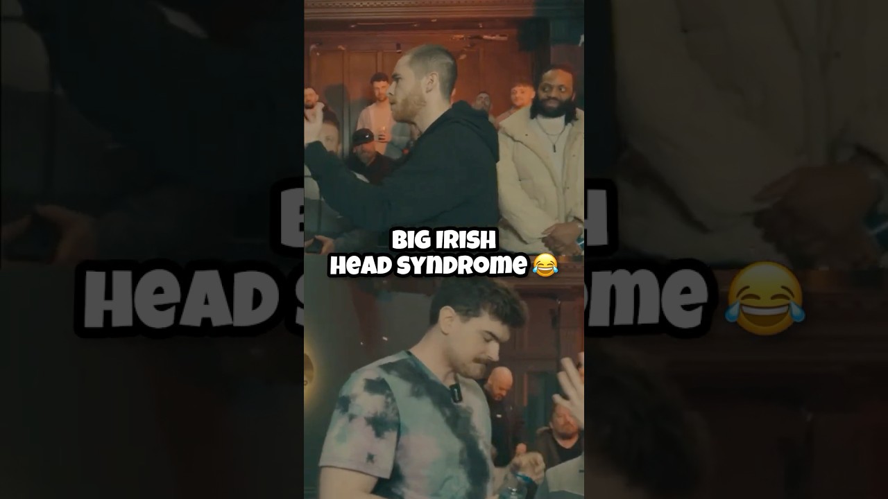 Big Irish Head Syndrome 😂