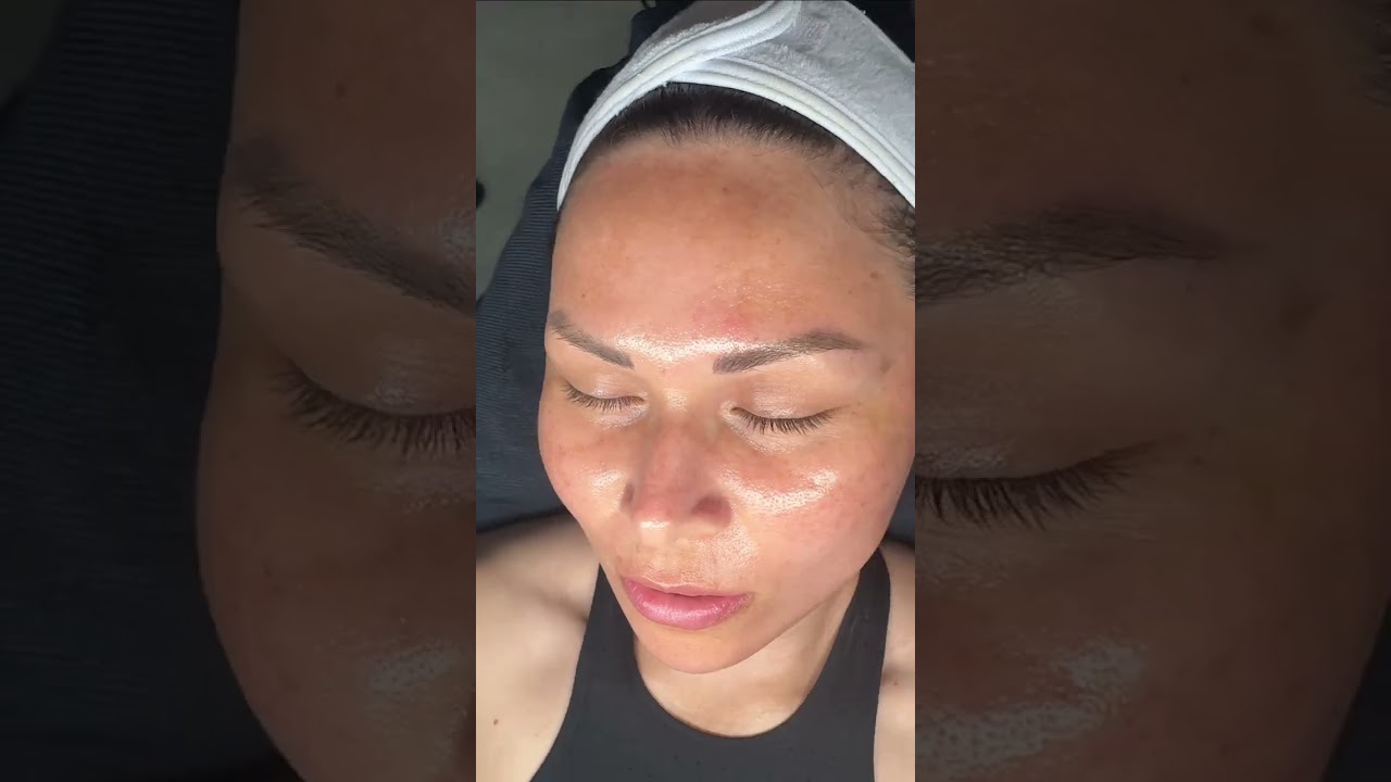 Diamond Glow Before and After