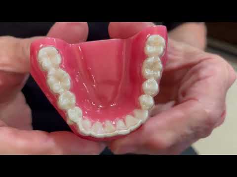 Invisalign December special!